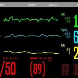 Ati virtual scenario vital signs answers